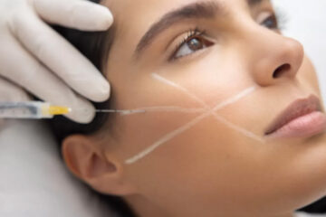 The Transformative Benefits of Sculptra for a Youthful Look