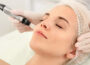 The Ultimate Guide to Microneedling Treatment in Suwanee, GA