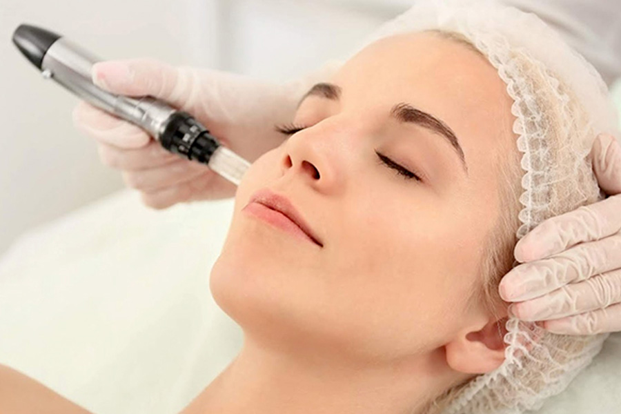 The Ultimate Guide to Microneedling Treatment in Suwanee, GA