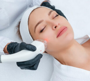 Transform Your Skin with Advanced Laser Treatments in Powell